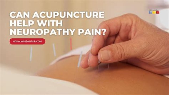 Do u have to get naked for acupuncture?