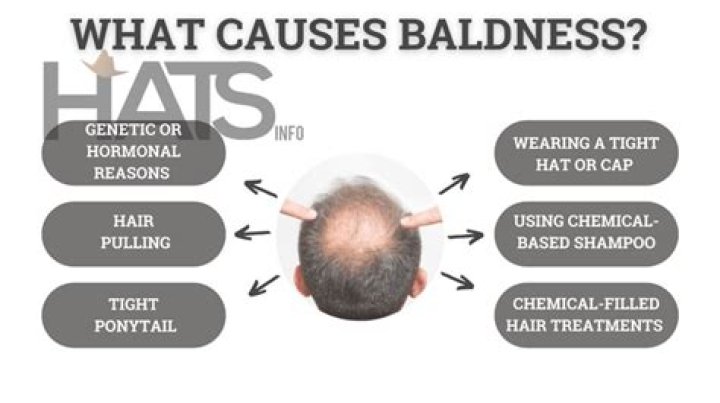 Does wearing scarf cause hair loss?
