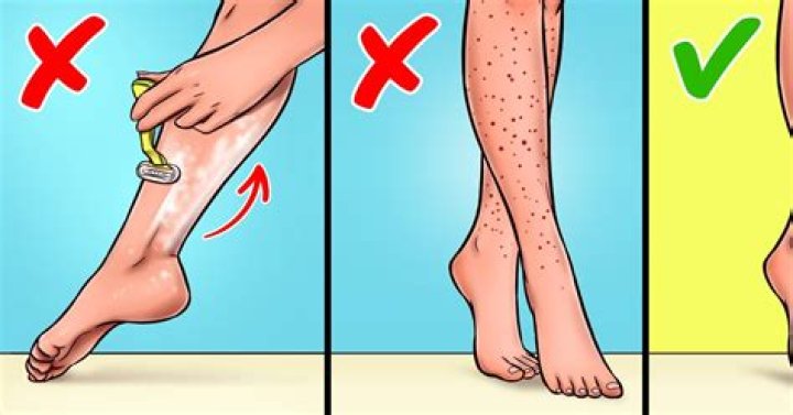 How can I make my legs look younger?