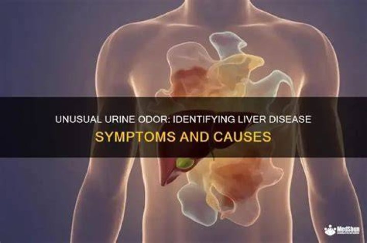 What does urine smell like with liver disease?