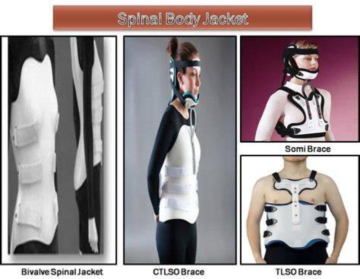What is a spinal jacket?