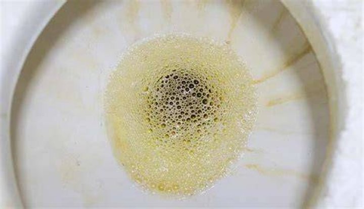 Why are there tiny bubbles in my toilet?