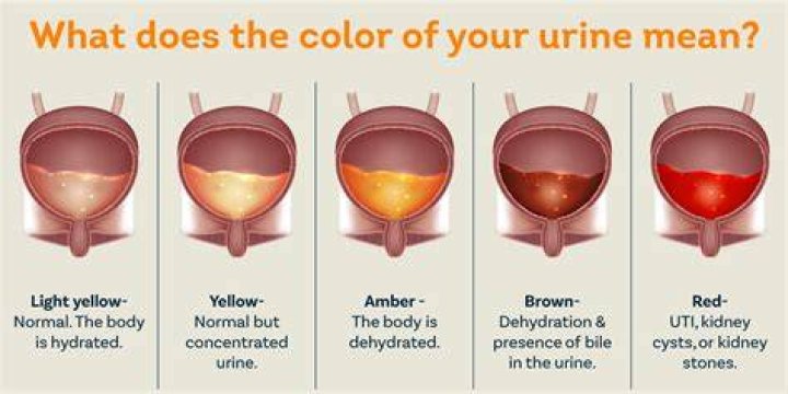 Why is there blood in my underwear female?